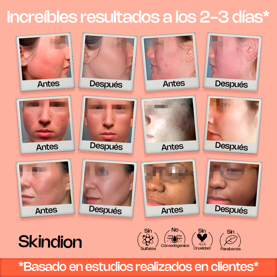 Skindion ExfoGlow - Bicarbonato Exfoliante
