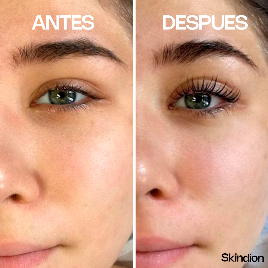 Skindion LashCurl - Rizador de Pestañas Térmico