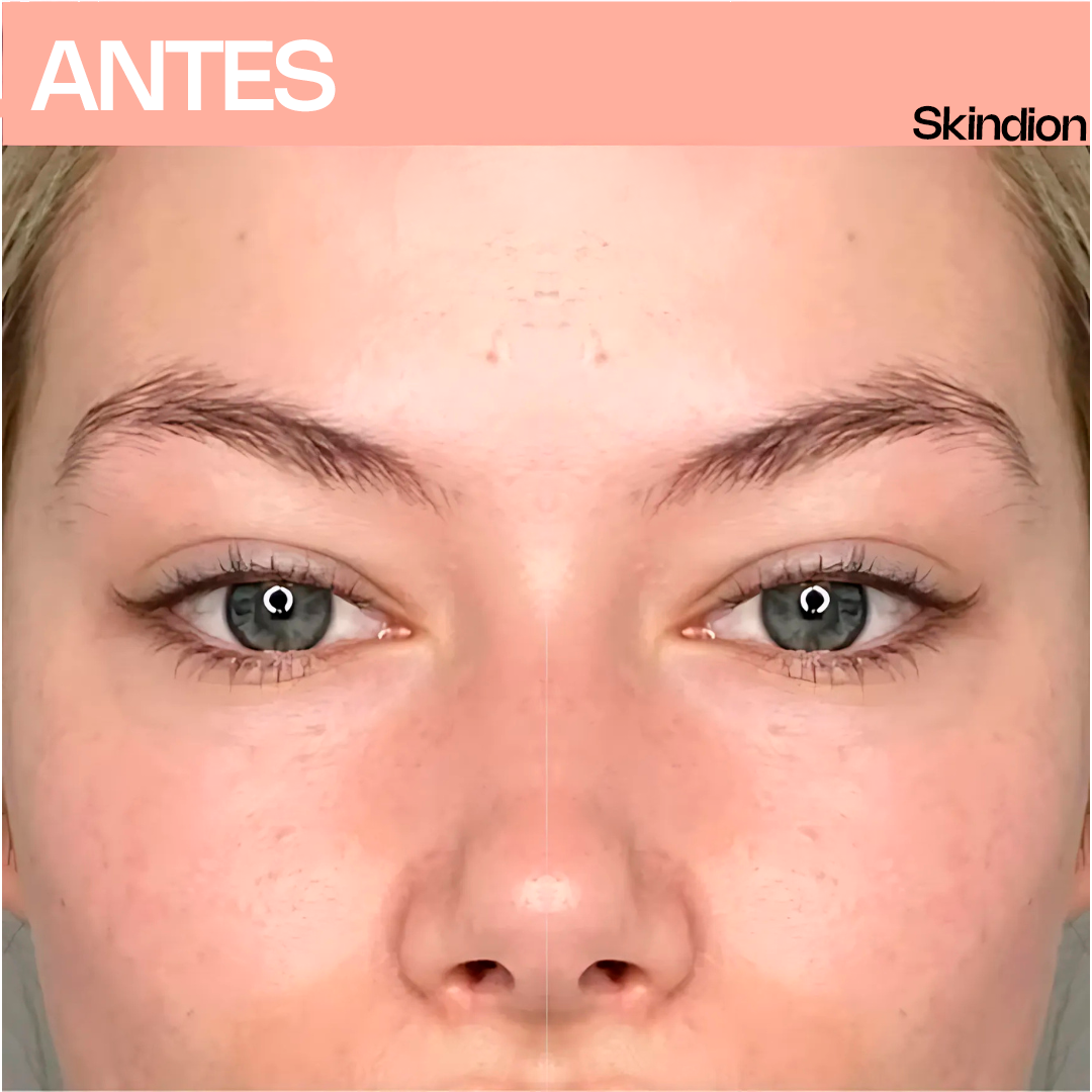 Skindion LashCurl - Rizador de Pestañas Térmico