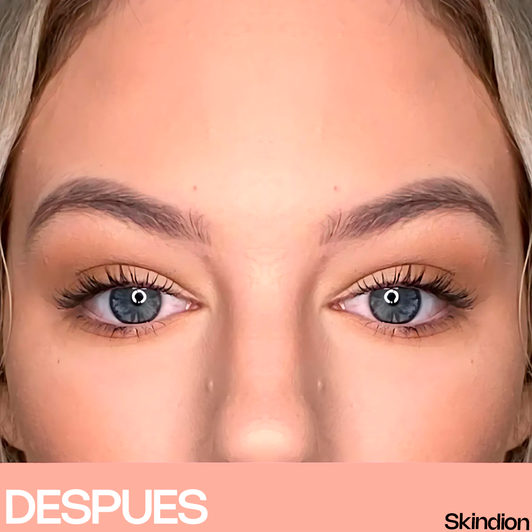 Skindion LashCurl - Rizador de Pestañas Térmico