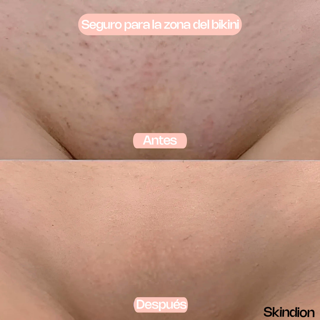 Skindion Smooth - Depilador de Cristal Instantáneo -