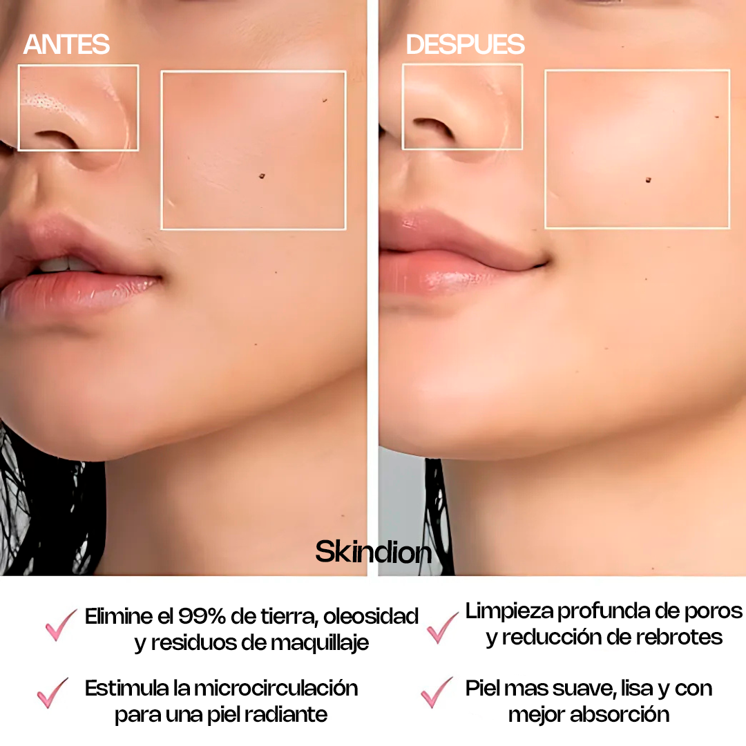 Skindion Glow - Limpieza Facial Sónica