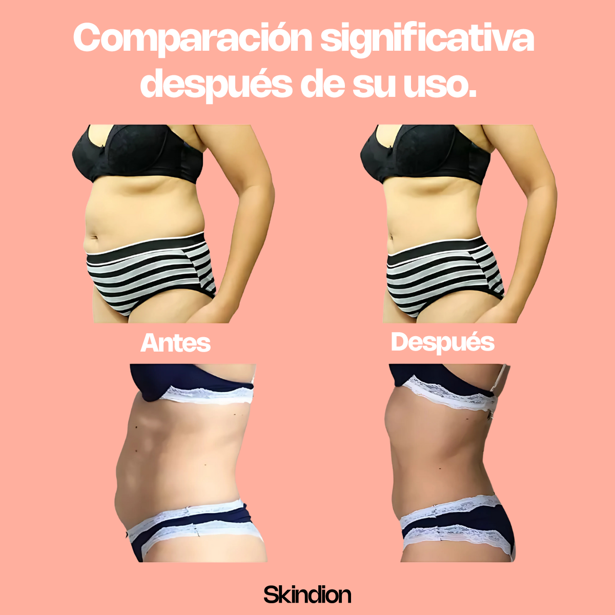 SlimPatch - Plan Detox & Drenaje Linfático