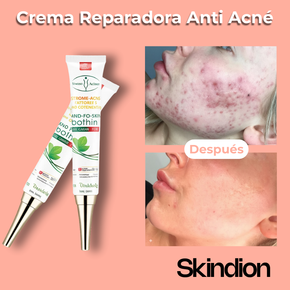 Piel Calma - Crema Reparadora Hidratante Anti Acné