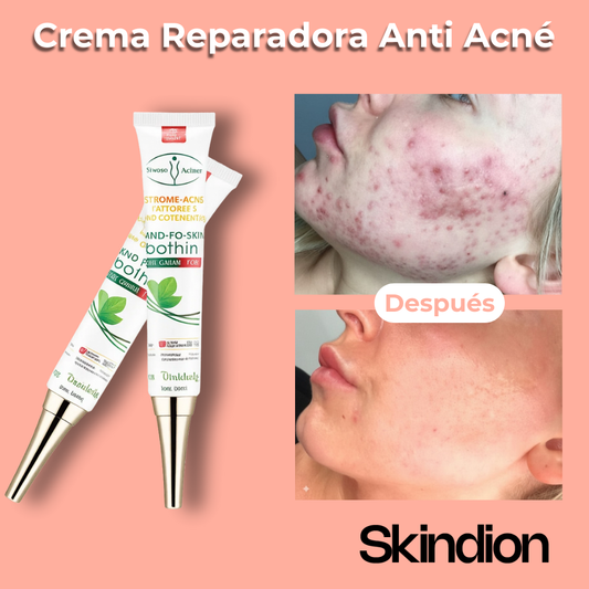 Piel Calma - Crema Reparadora Hidratante Anti Acné