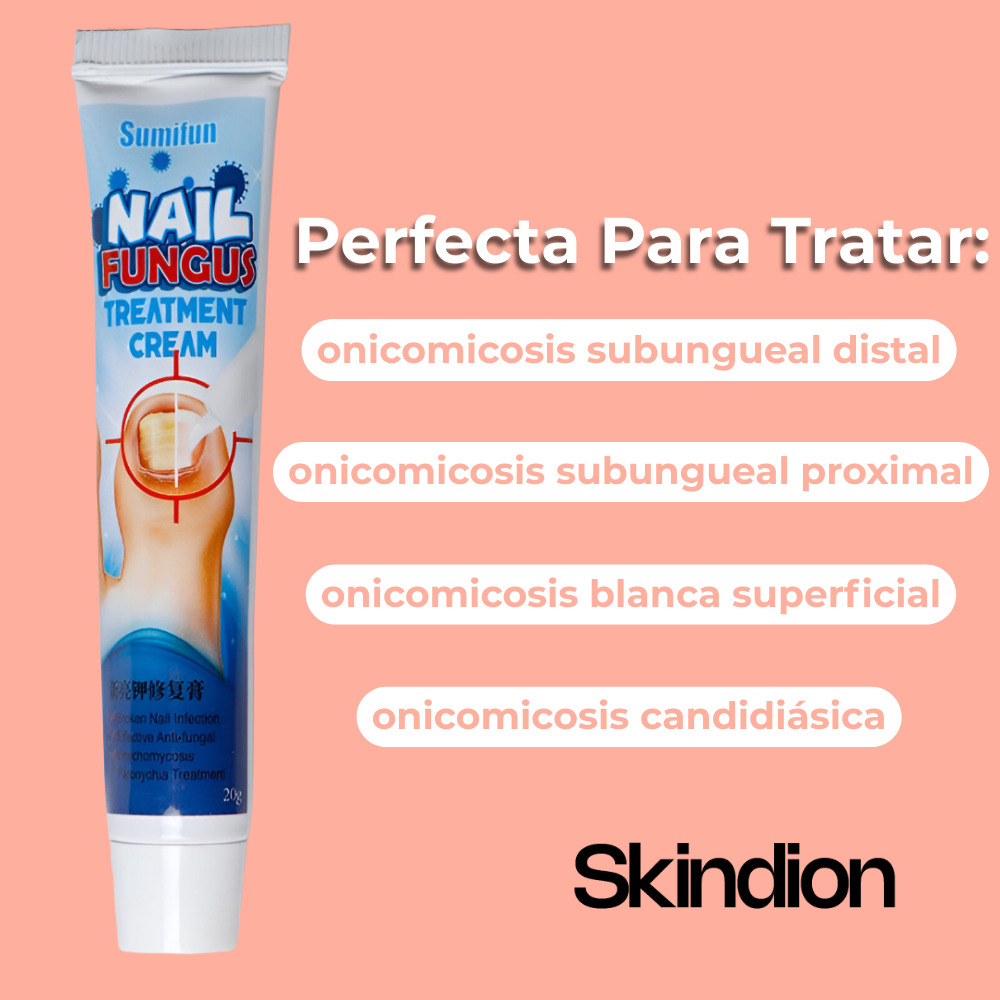 Crema Anti Hongos