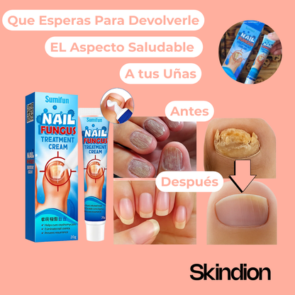 Crema Anti Hongos