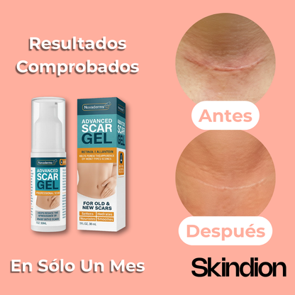 Gel Cicatrizante - Atenua y Desaparece Tus Cicatrices