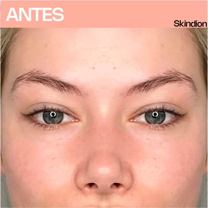 Skindion LashCurl - Rizador de Pestañas Térmico
